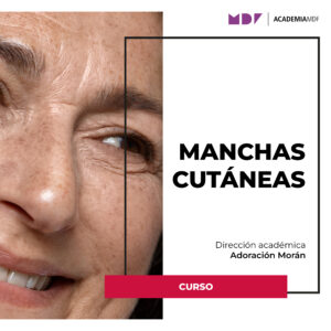 Manchas cutáneas