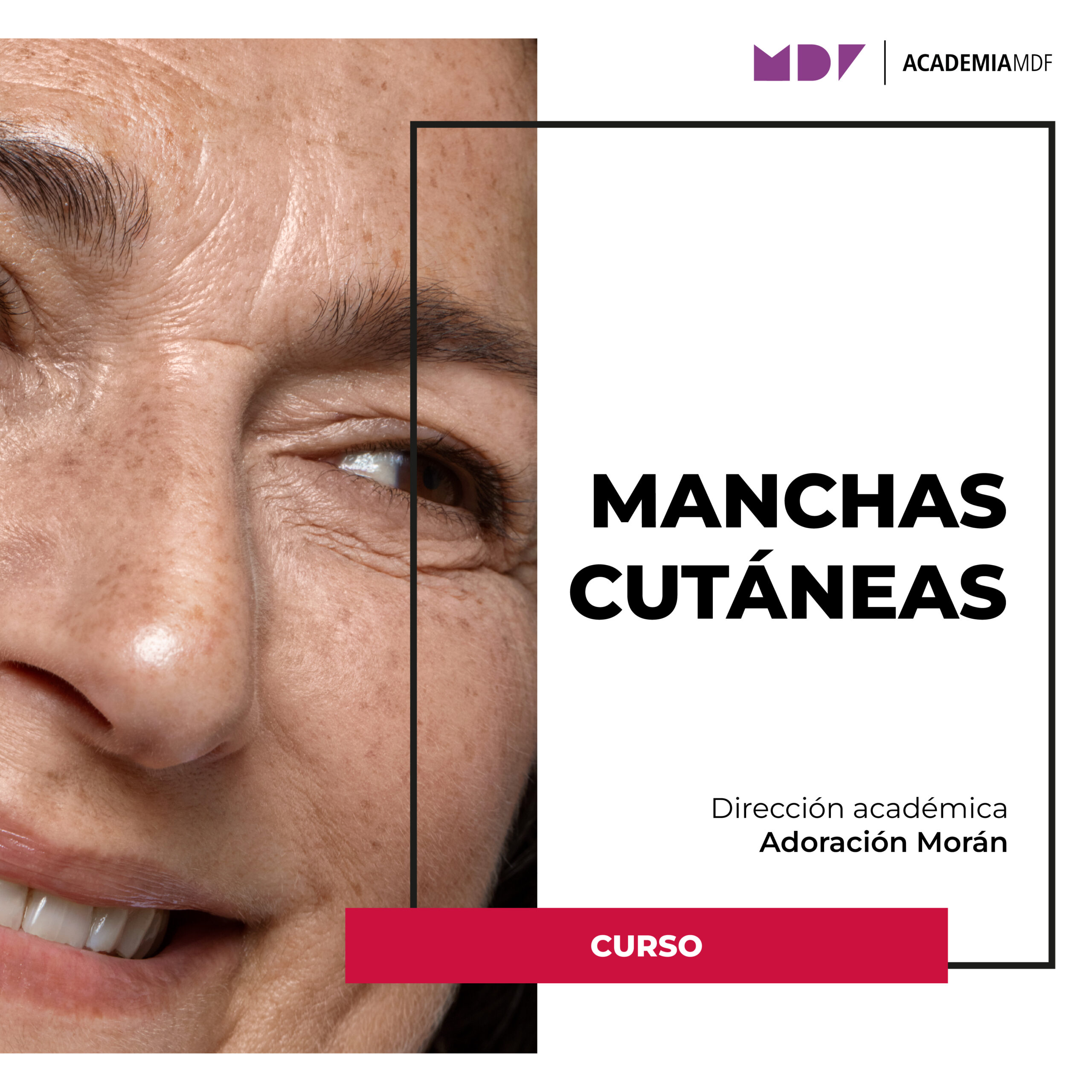Manchas cutáneas